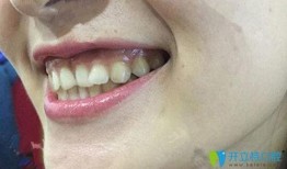 广州雅度口腔爆料事件最新,揭露行业乱象，患者权益引关注